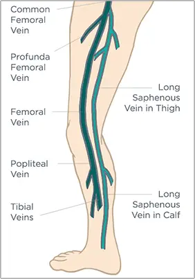 Demo - The Ultimate Guide to Veins, Varicose Veins and Spider Veins